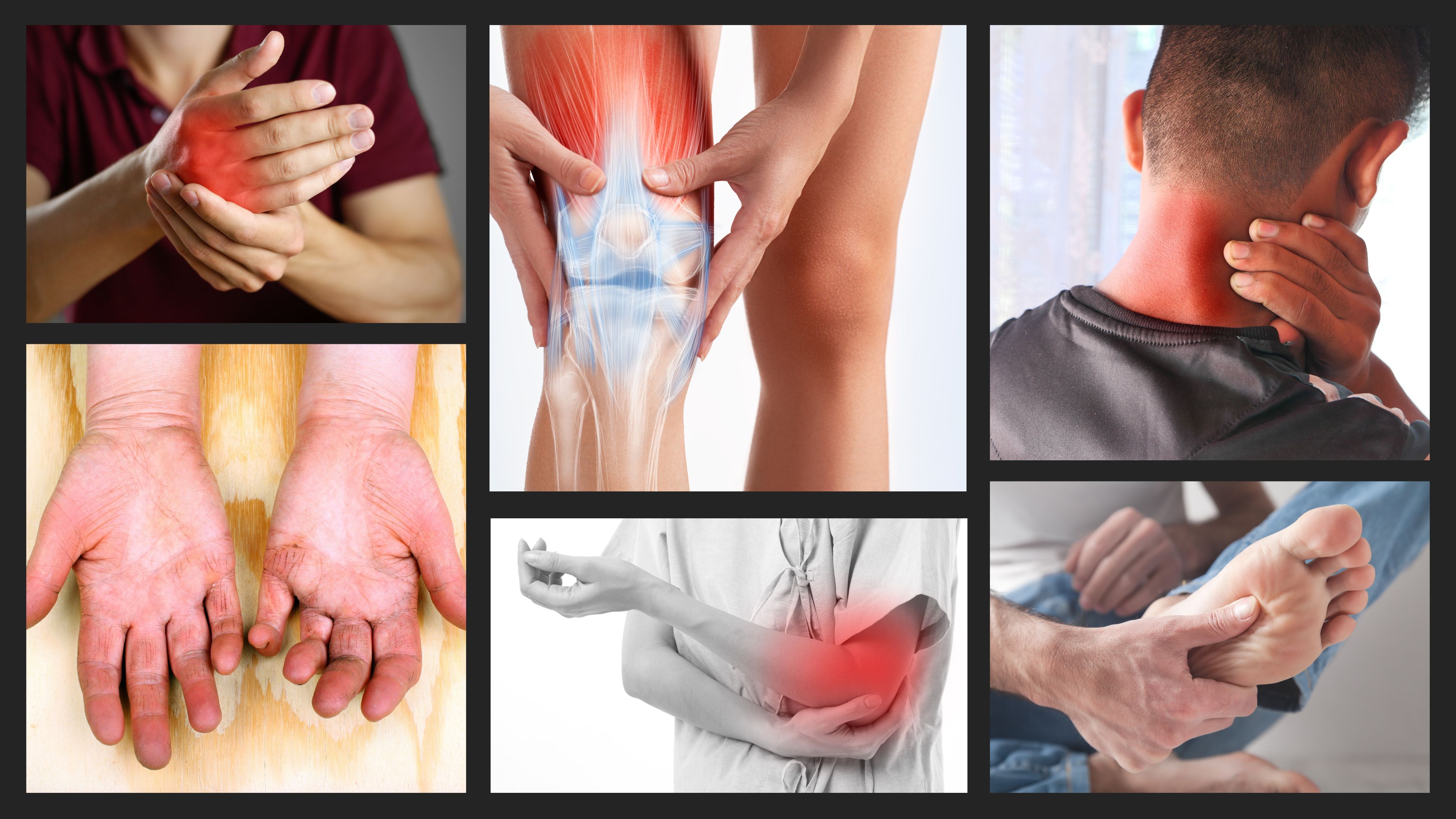 আর্থ্রাইটিস কেন হয়, লক্ষণ ও চিকিৎসা