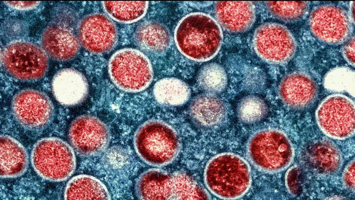 এমপক্স: বাংলাদেশ ও পাকিস্তান সীমান্তে সতর্কতা বাড়াল ভারত