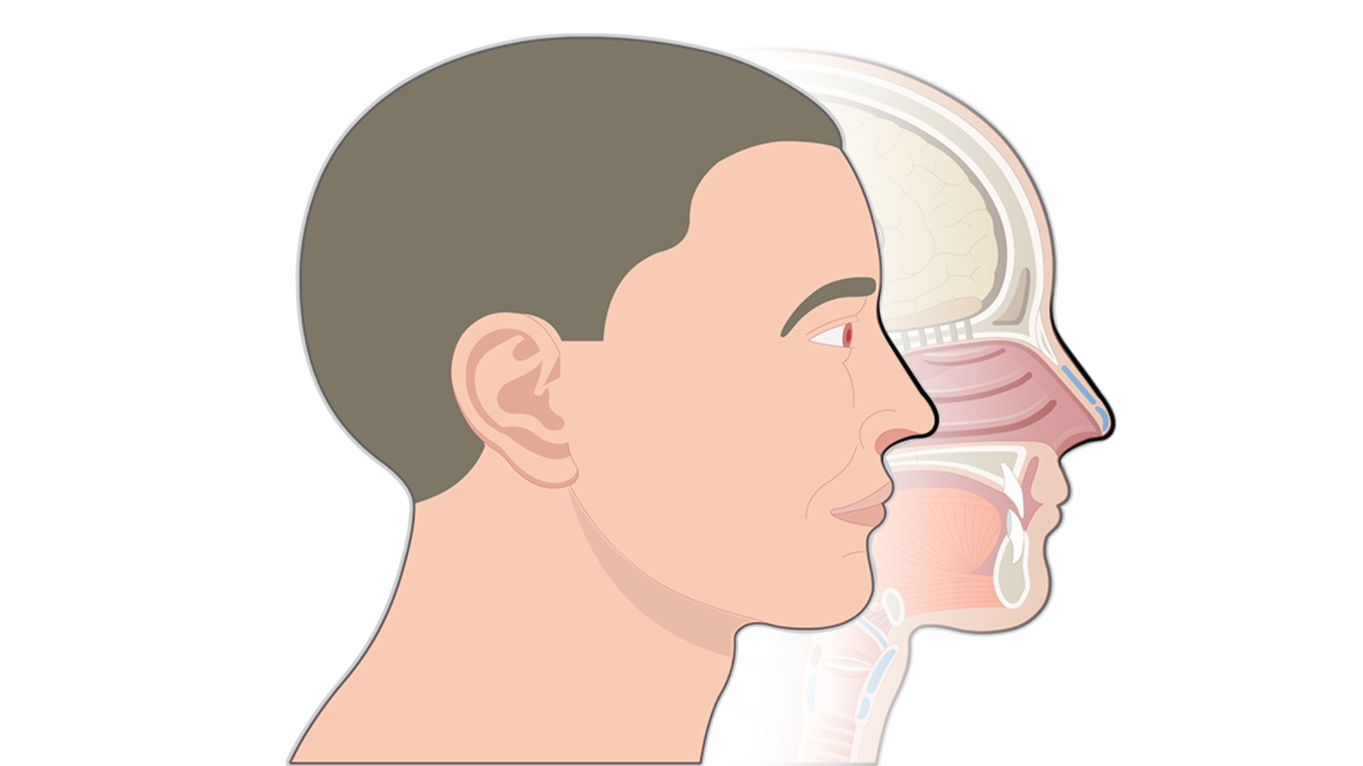 নাকের পলিপ কী, কেন হয়