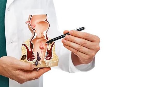 পাইলস কেন হয়, লক্ষণ ও চিকিৎসা কী