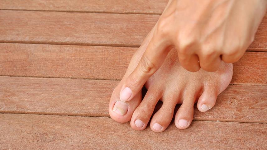 নখের কোনা দেবে যাওয়া