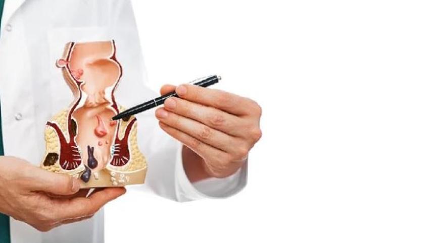 ফিস্টুলা