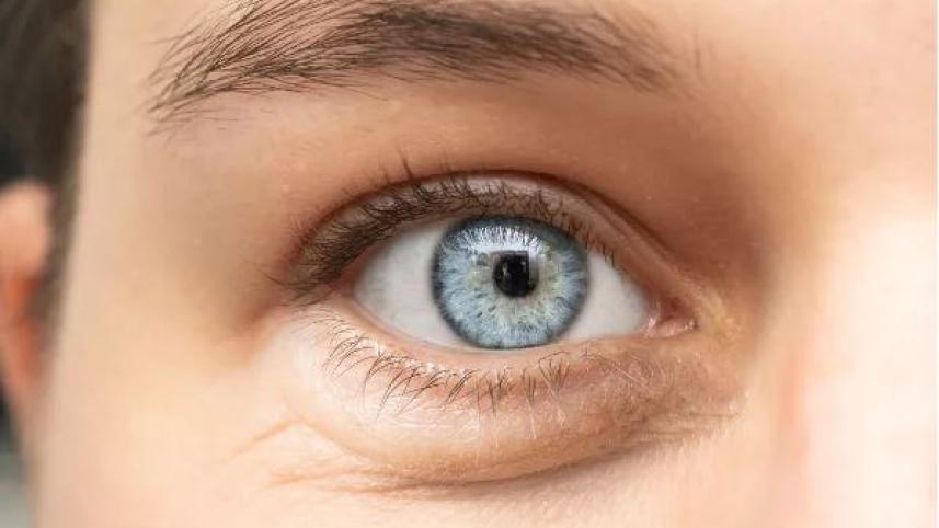 চোখের স্ট্রোক